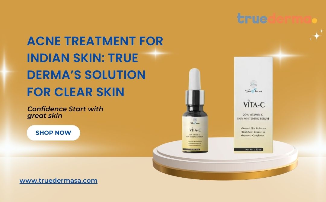 Acne Treatment for Indian Skin: True Derma’s Solution for Clear Skin