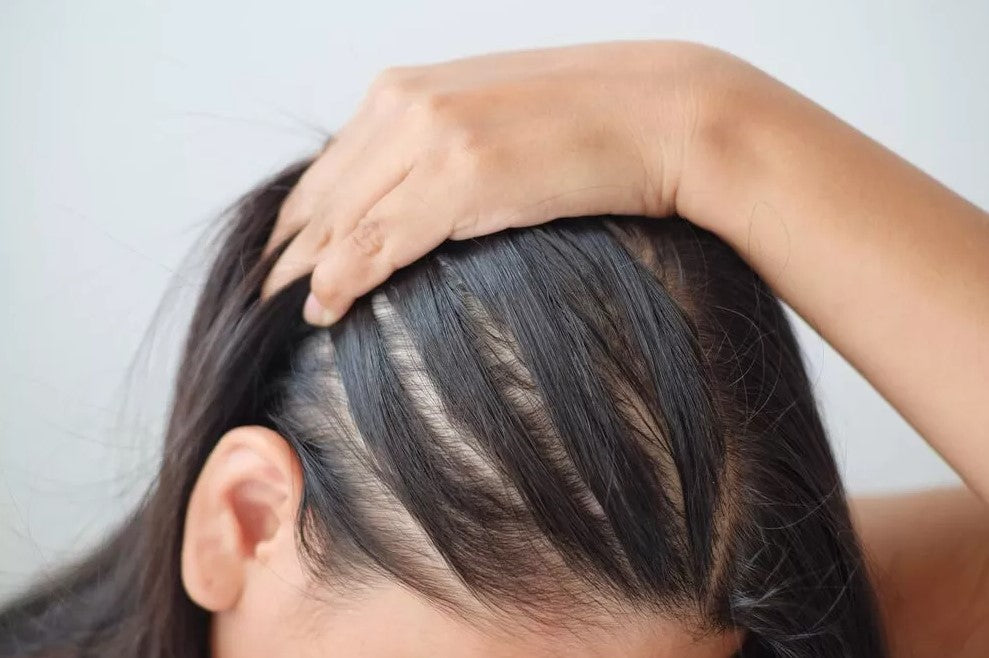 Can Hair Products Contribute to Hair Loss?