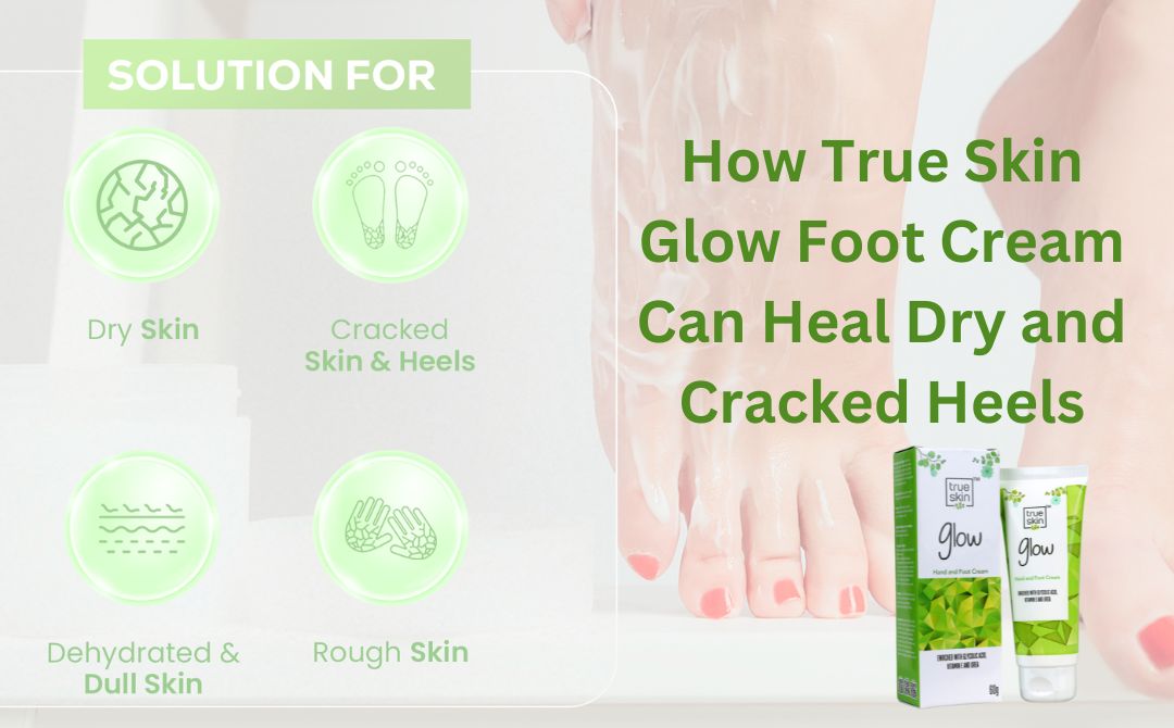 How True Skin Glow Foot Cream Can Heal Dry and Cracked Heels