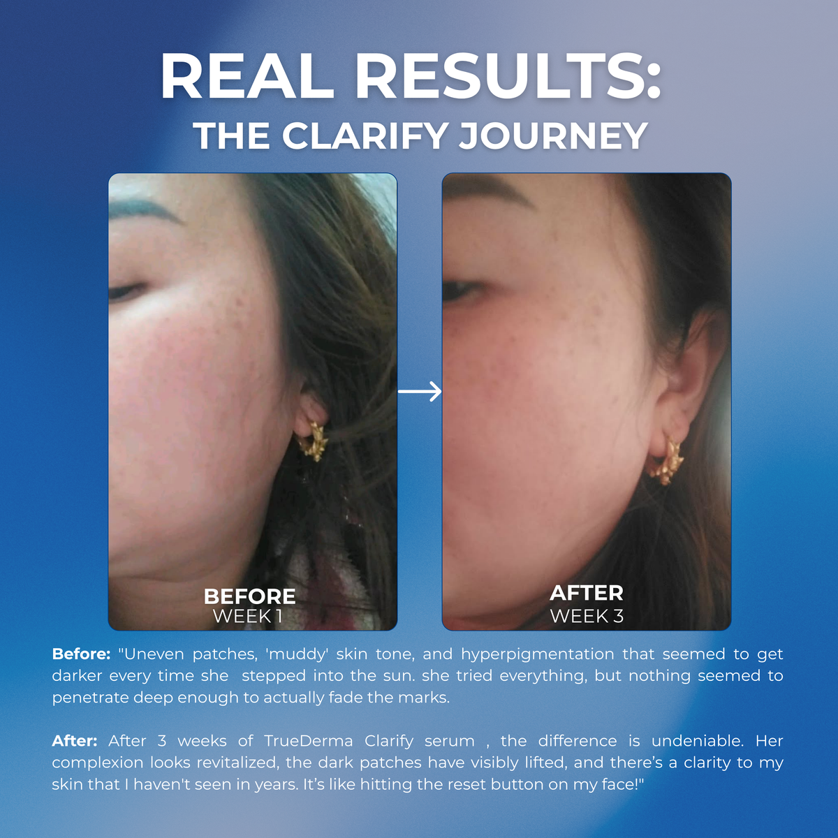 A promotional before-and-after comparison graphic showing a woman&