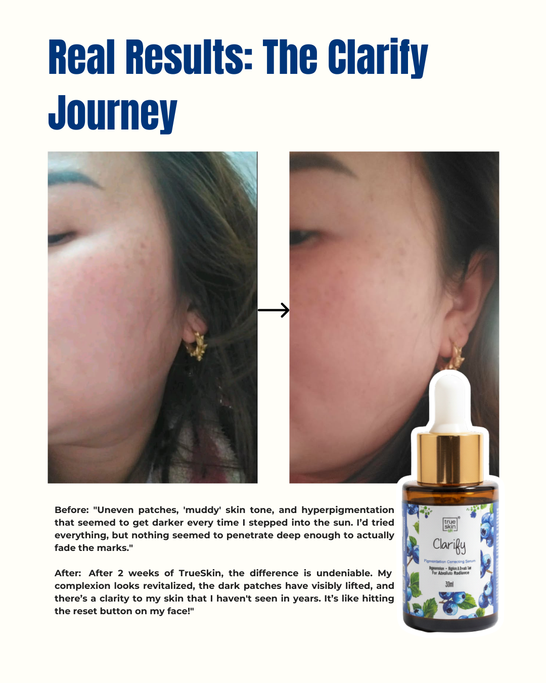 Before and after skin comparison with a bottle of Clarify skincare product.